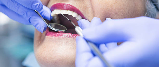 Best Chipped Tooth Repair Near Me  in Webster, SD